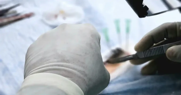 chirurgie levre vulve