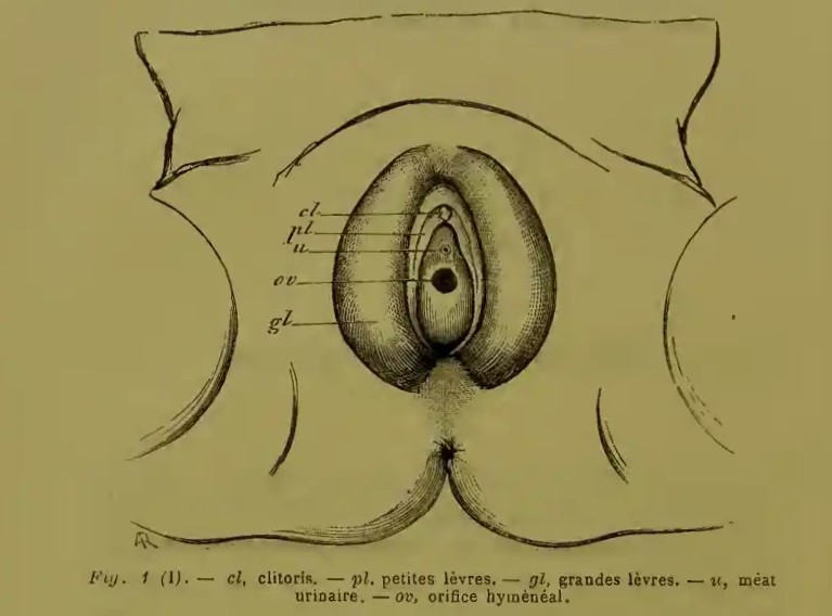 schéma de la localisation de l'hymen